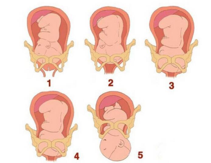 耻骨越痛 分娩越容易 关于耻骨痛的4个问题 孕妇要清楚