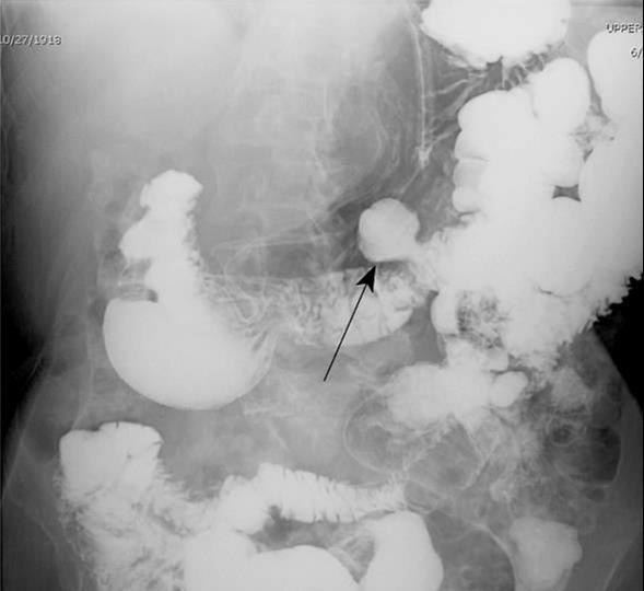 左下腹疼 有哪些常见的病因 该咋办 医生给您讲清楚